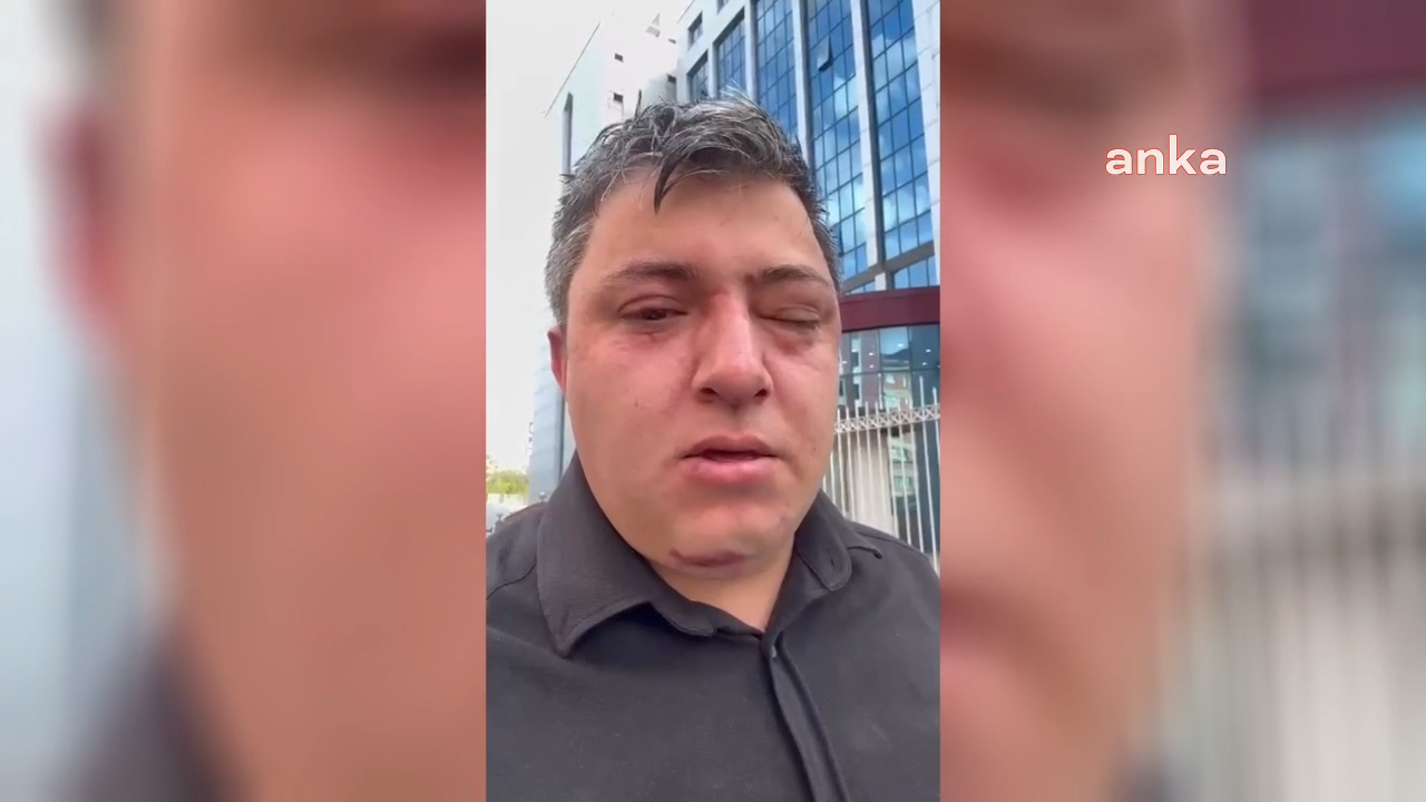 Altındağ Belediyesi personeli Erdoğan, Altındağ Belediye Başkanı Tiryaki ve yardımcıları tarafından darp edildiğini ileri sürdü: ''20 dakika darba maruz kaldım''